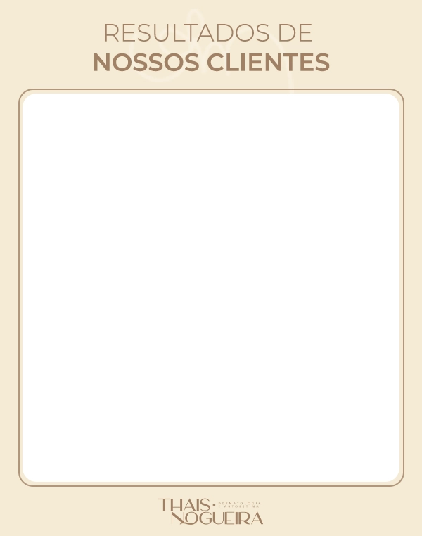 Antes e Depois Dra Tais 02